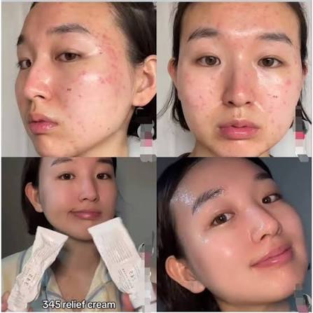 345 Relief Cream & Mist.