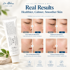 345 Relief Cream & Mist.